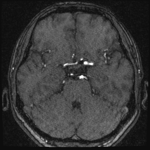 Click on the Serie image to view the images of VILLANUEVA, WILLIAM A.